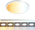 zemty 7 inch Small White LED Flush Mount Ceiling Lights, Dimmable 5 Color Temp (3000K-6500K), 1500LM 15W Round Recessed Light Fixture for Closet Kitchen Bathroom Bedroom, 1Pack